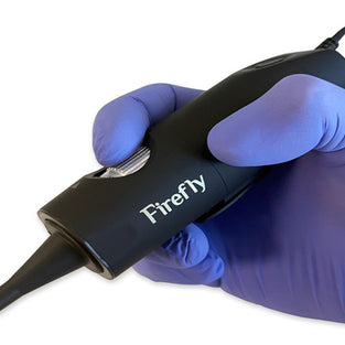 Firefly DE508 4K Resolution Video Otoscope - Wired