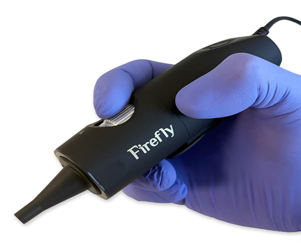Firefly DE508 4K Resolution Video Otoscope - Wired