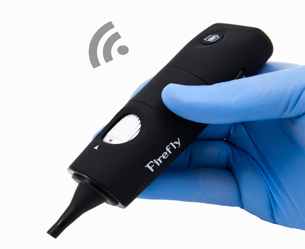 Firefly DE550 Wireless Digital Video Otoscope PC/MAC