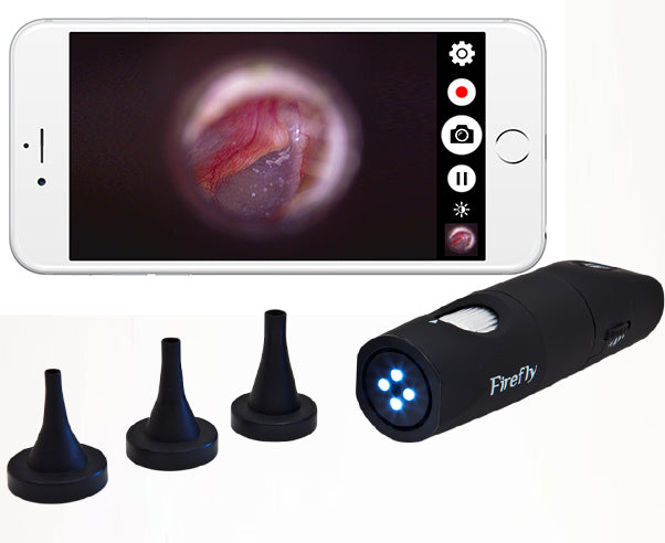 Firefly DE570 HD Wireless Video Otoscope Mobile