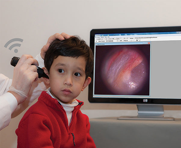 Firefly DE550 Wireless Digital Video Otoscope PC/MAC