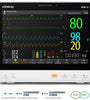 Mindray ePM12 Patient Monitor